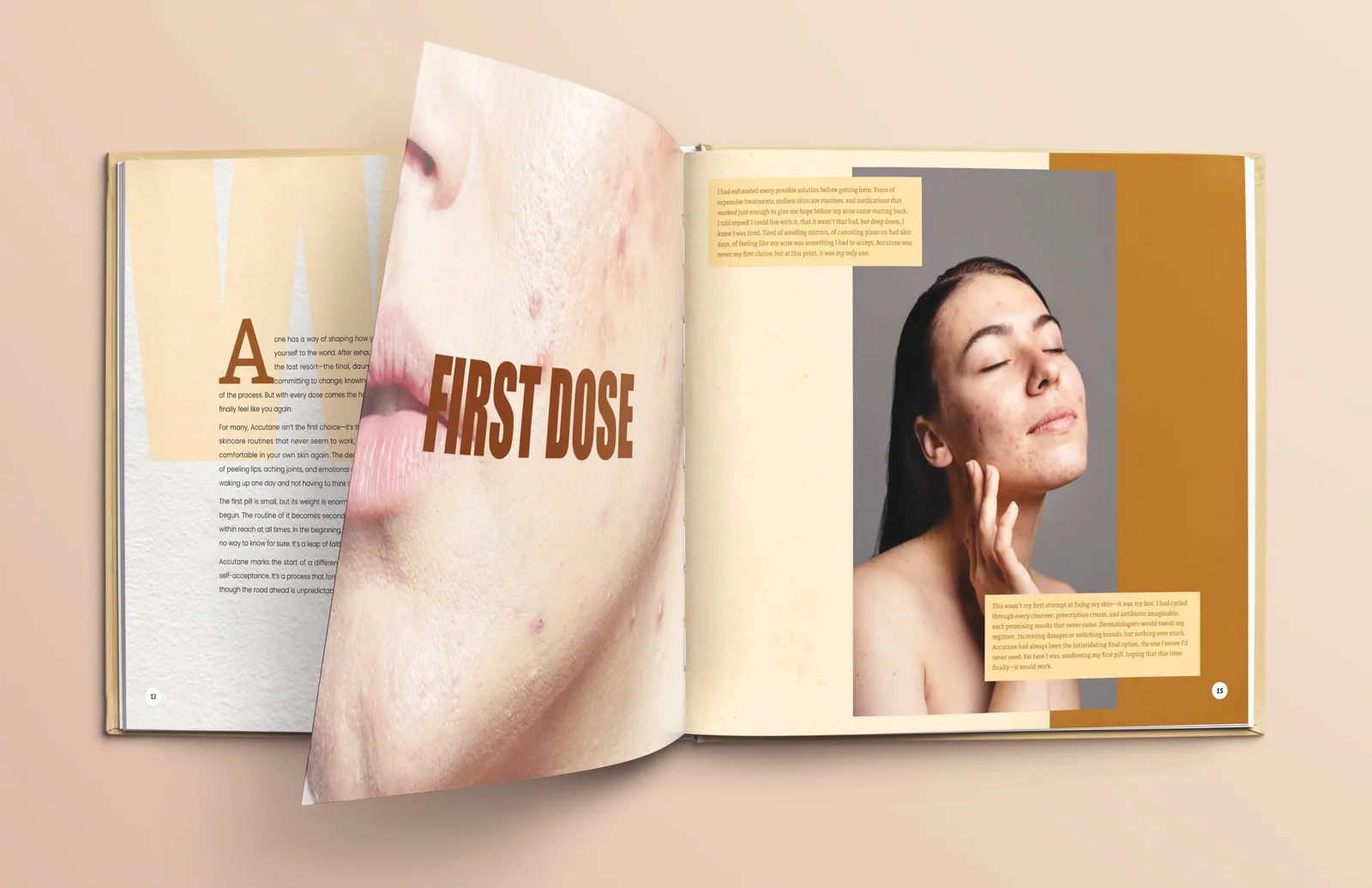Accutane: A Scarred Controversy — image 8