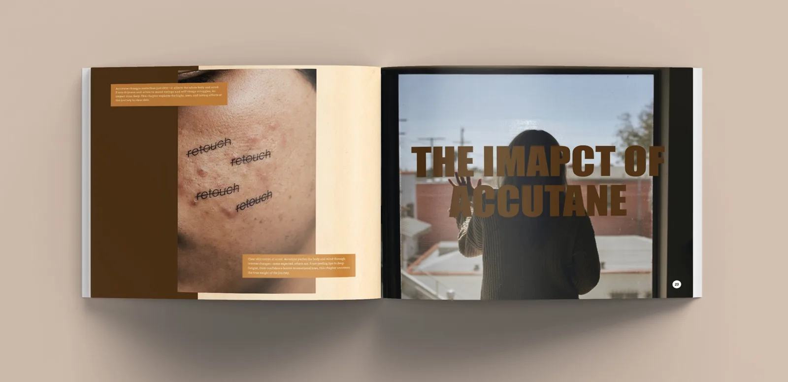 Accutane: A Scarred Controversy — image 12