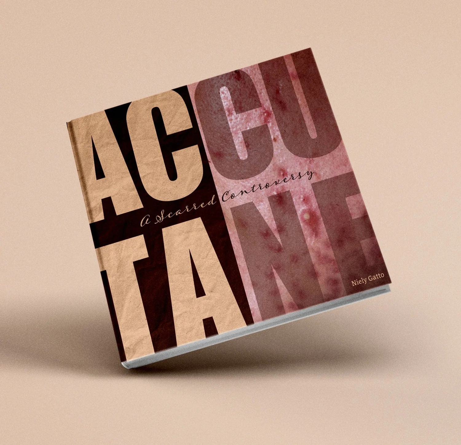 Accutane: A Scarred Controversy book cover mockup